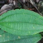 Miconia calvescens List
