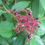 Miconia lacera Fruit