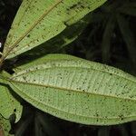 Miconia conorufescens List